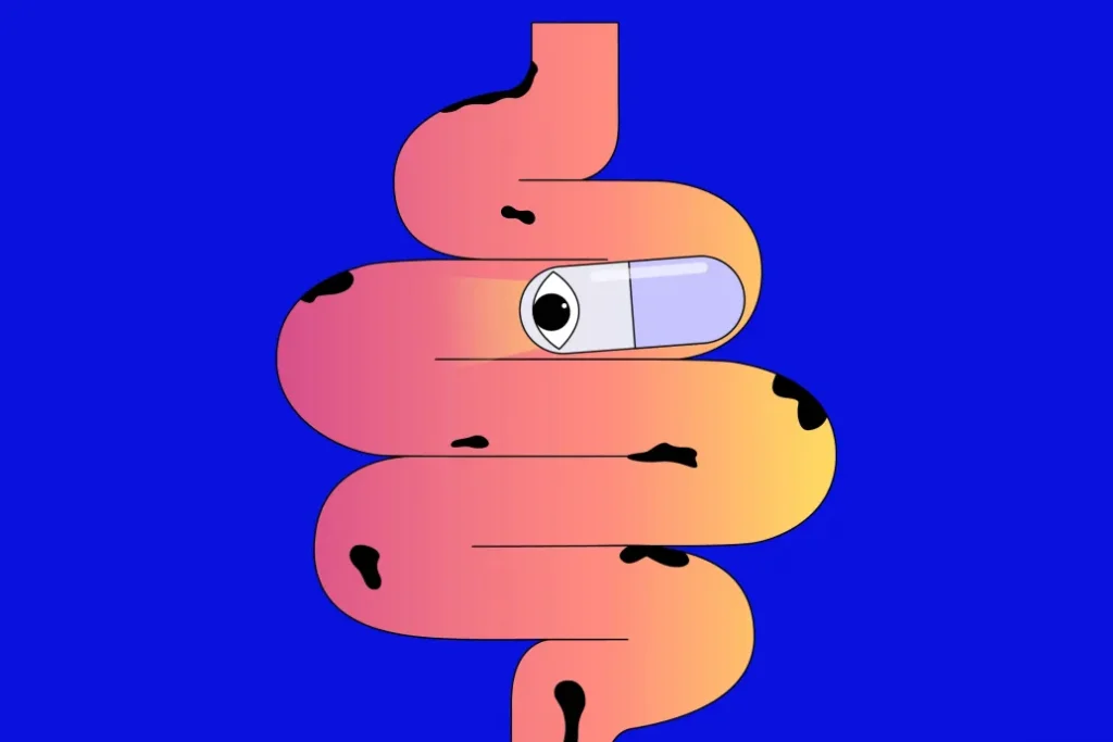 1733991836-temp-dHljNn_cimlap-normal