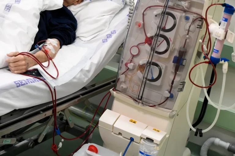 Nincs elég vesedonor és nővér, néha pedig dialízis közben romlanak el a gépek