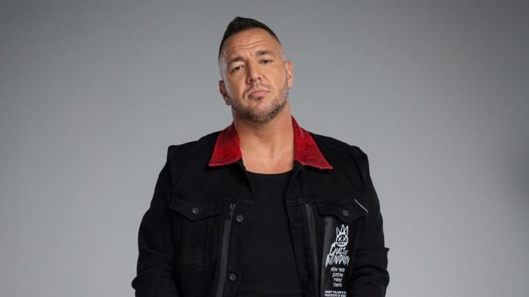 Egy éve volt Curtis hajbeültetése: így néz ki most a rapper