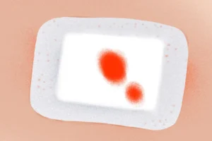 Tálos Atanáz: Kés