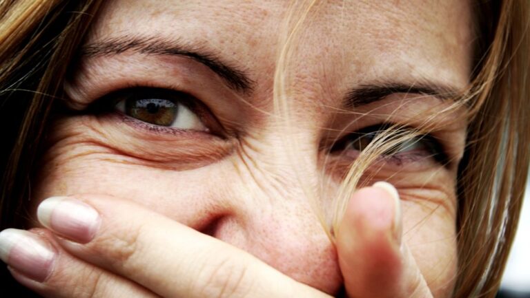 Ha nevet, fáj a feje, mert kiesett az agya a helyéről