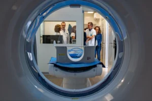 Nőhet a tüdőrák kockázata a súlyos koronavírus- és influenzafertőzés után