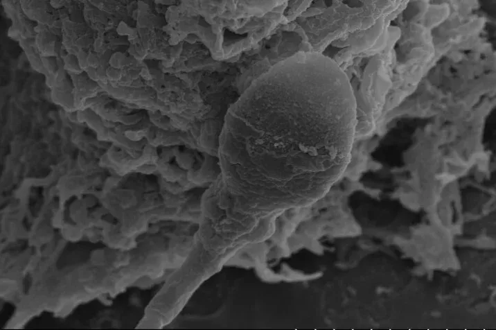 Figyelmeztetnek a tudósok: nehezebb lehet gyereket csinálni az űrben, mint eddig gondoltuk